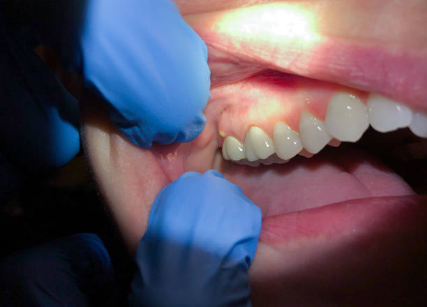Best After-Hours Dental Trauma Care in Hidden Meadows, CA