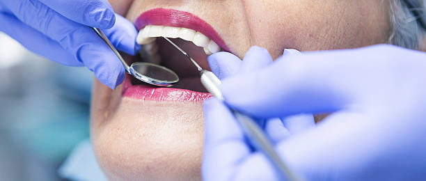 Best Emergency Treatment for Dental Infections or Abscesses in Hidden Meadows, CA